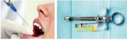 胰島素，牙科麻醉6.png